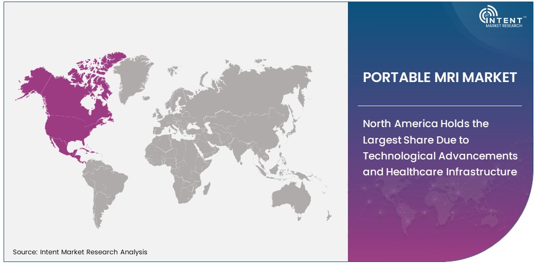 Portable MRI Market  Size by Region 2030
