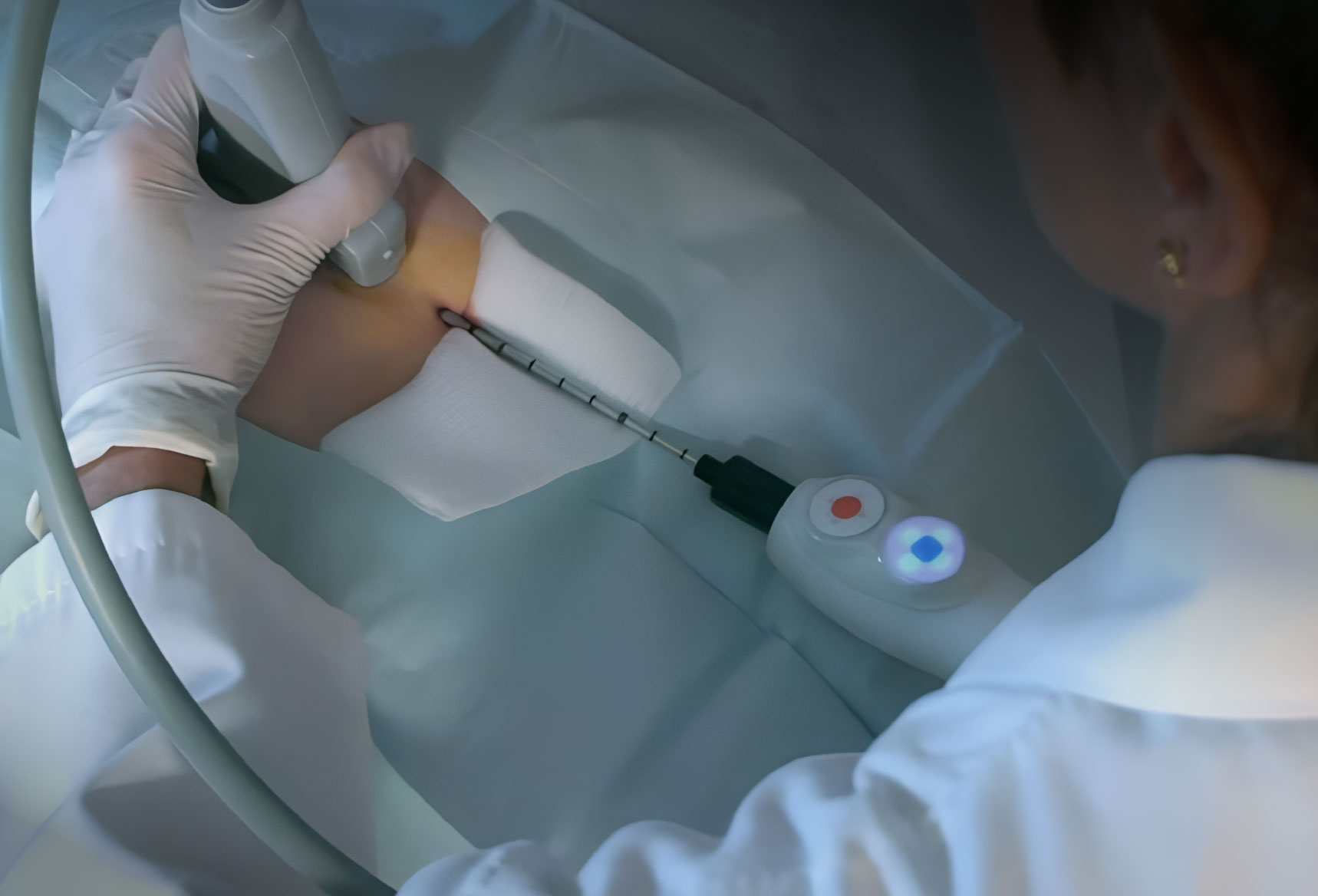 Breast Biopsy Devices Market: Innovation & Early Detection